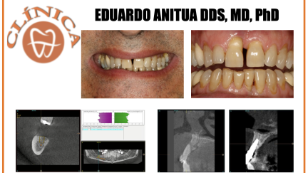 Abordagem multidisciplinar para a resolução de um caso complexo recorrendo a várias áreas da medicina dentária