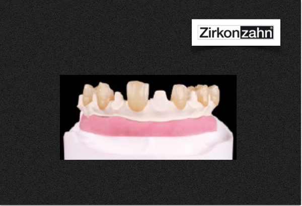 Tecno Med Mineral da Zirkonzahn agora nas cores tissue e dentina