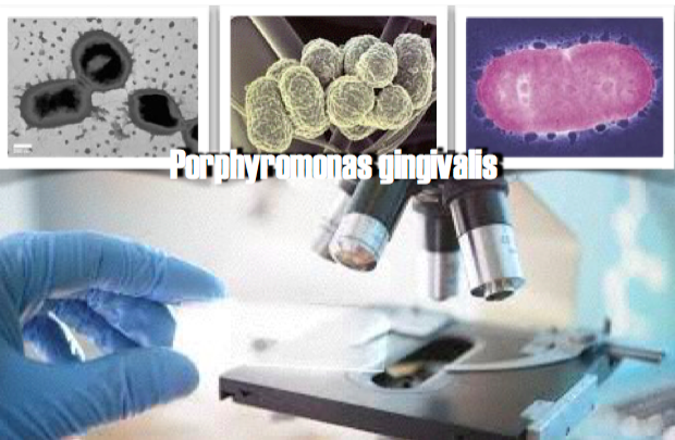 Estudo: Bacteriocina inibe Porphyromonas gingivalis e estimula a cicatrização de tecidos.