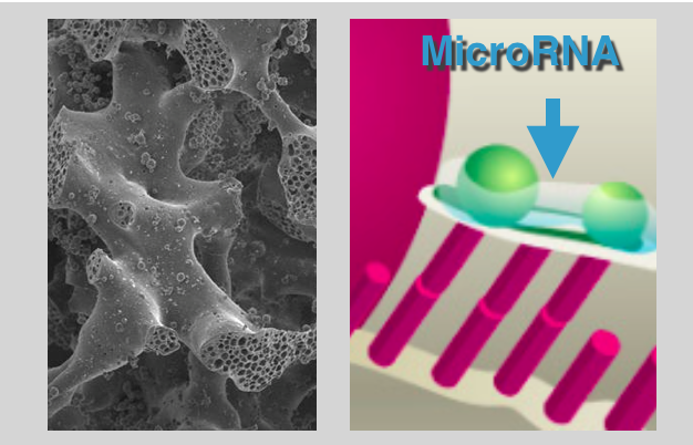 Nanotecnologia poderá melhorar a restauração óssea em medicina dentária