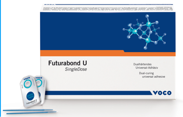 Adesivo universal Futurabond U – um só bond para todos os casos