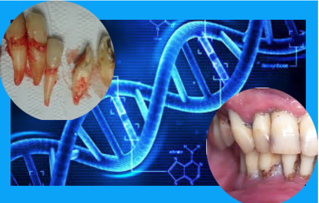 Identificadas sequências de DNA responsáveis pela periodontite