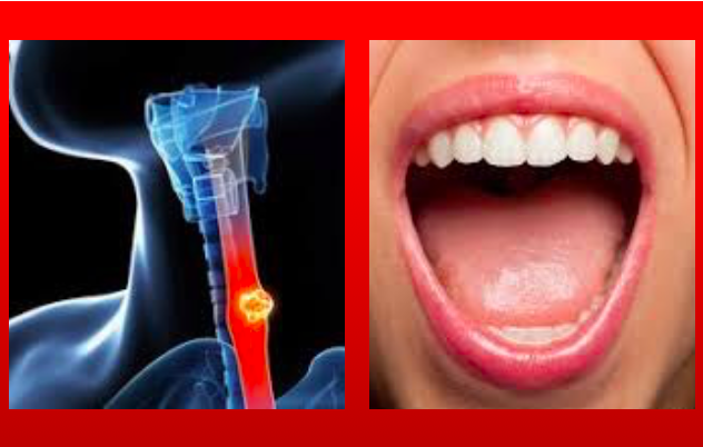 A microbiota oral indica relação entre doença periodontal e o cancro do esófago