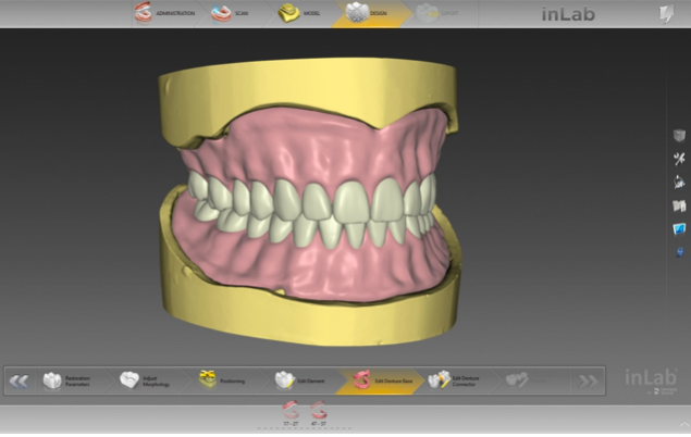 Próteses totais fabricadas digitalmente com software inLab 20.0