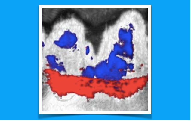 O novo método de imagem dental usa tinta de choco para detetar doença das gengivas