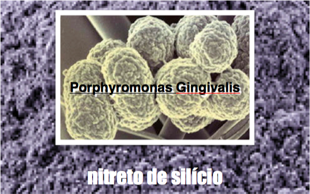 Como a biocerâmica pode ajudar a combater a periodontite