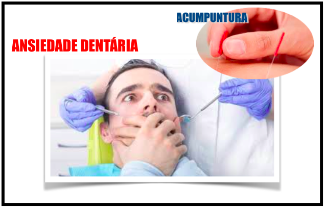 Ansiedade dentária e a acupuntura