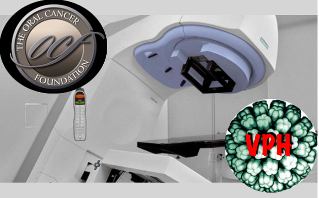 Redução da radiação trata com sucesso os cancros orofaríngicos provocados por VPH minimizando os efeitos colaterais