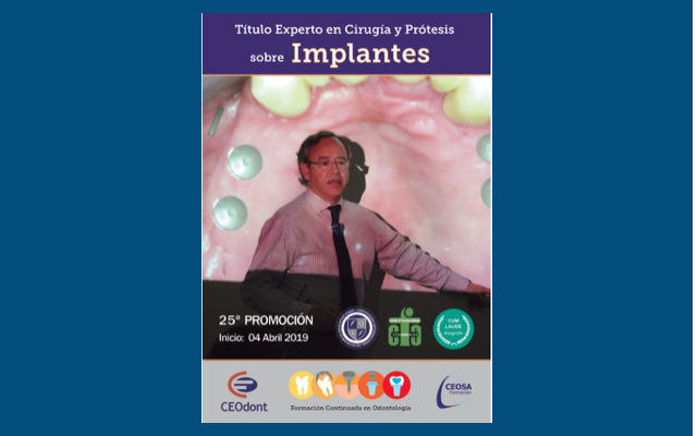 Cirurgia e Prótese sobre implantes em destaque