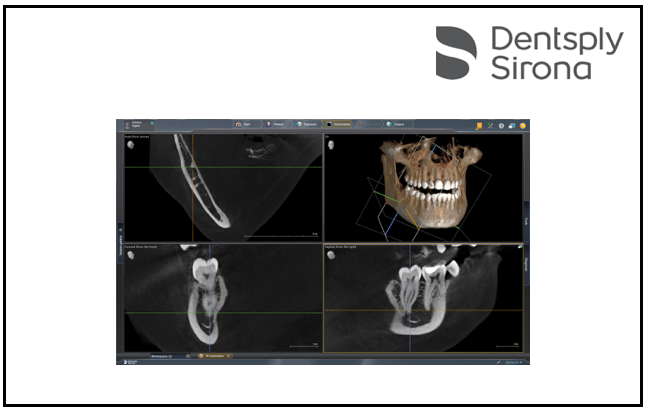 Dentsply Sirona lança Sidexis 4 versão 4.3 e atualiza Orthophos SL