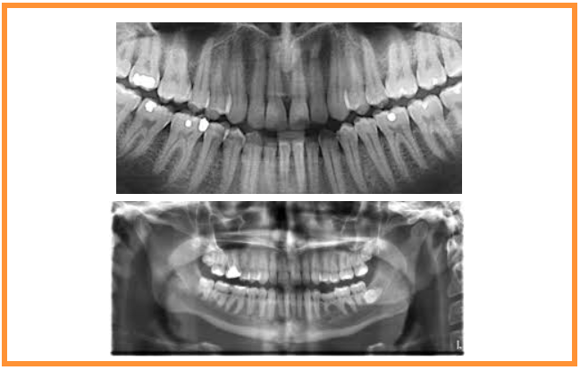 Tecnologia na medicina dentária pode ajudar os médicos dentistas a diagnosticar problemas mais rapidamente