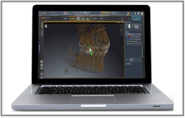 Novo SICAT Endo da Dentsply Sirona quer otimizar  tratamentos endodôdnticos