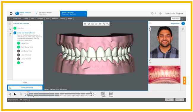 Software SureSmile 7.6: mais versatilidade em função das preferências de tratamento e mais controlo para os utilizadores