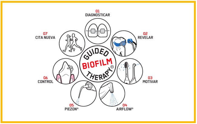 EMS apresenta novo método de Guided Biofilm Therapy