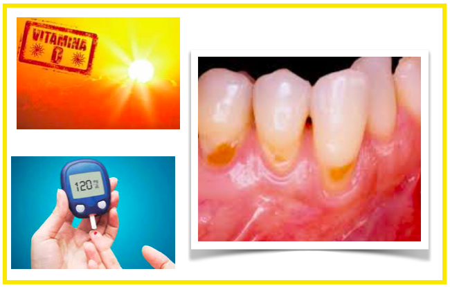 Qual é a ligação entre a vitamina D, a saúde das gengivas e a diabetes?