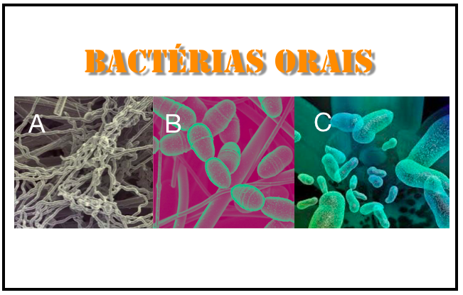 As bactérias da doença periodontal mesmo depois de mortas continuam a causar danos