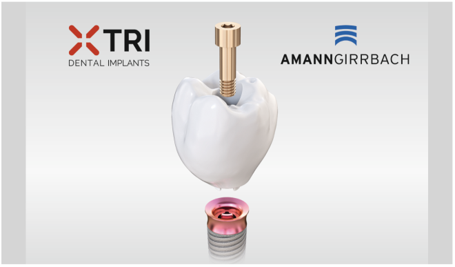 Implantes dentários sem pilar em fluxo de trabalho totalmente validado