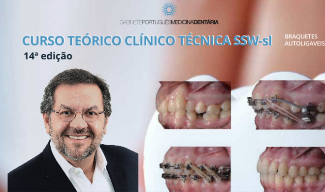 Curso Teórico/Clínico Técnica SSW —sl  Braquetes Autoligaveis