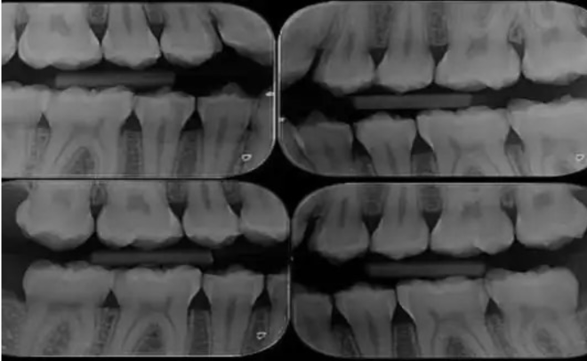 Inteligência Artificial (IA) na Medicina Dentária