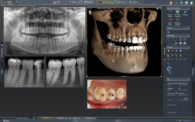 Dentsply Sirona apresenta software Sidexis 4