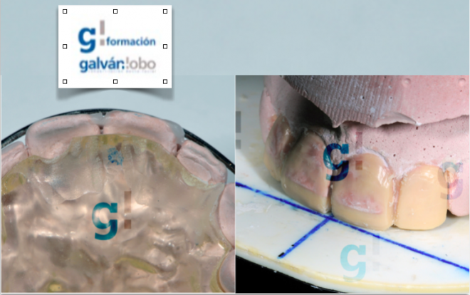 Curso de Oclusão e Medicina Dentária Restauradora