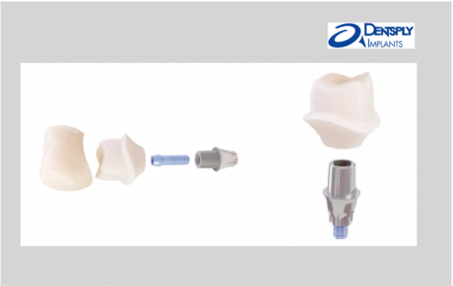 Novo TitaniumBase EV da Dentsply Implants