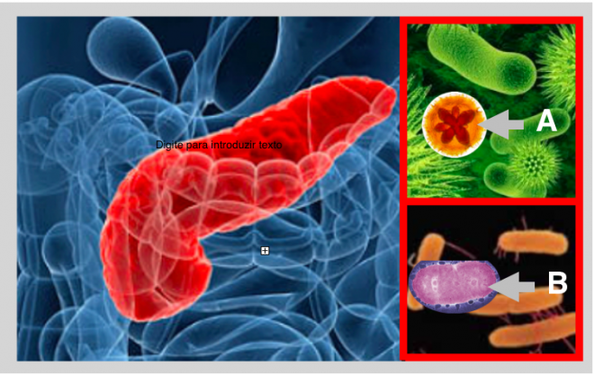 Risco de cancro pancreático associado a bactérias orais específicas