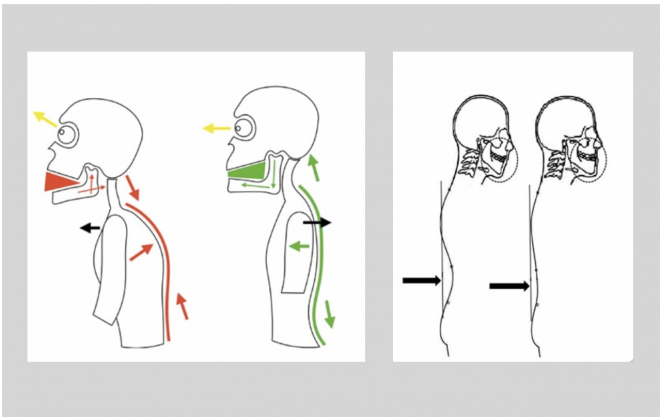 Influência da postura corporal na Má-Oclusão e Distúrbios da Articulação Temporomandibular