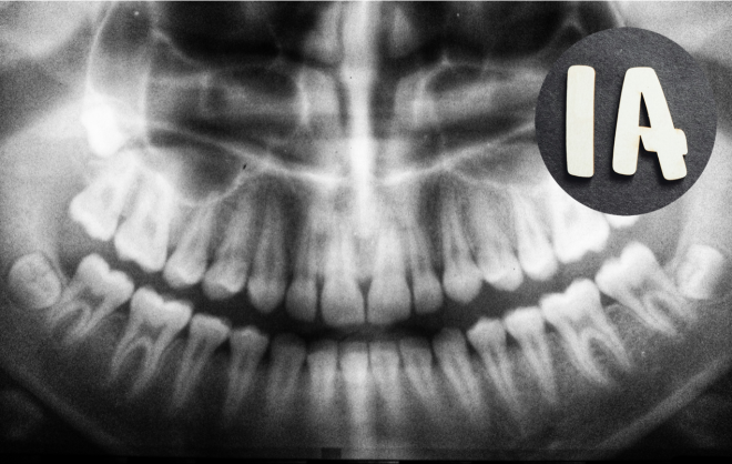 Deteção precoce do cancro oral com  utilização de  algoritmos de Inteligência Artificial (IA)