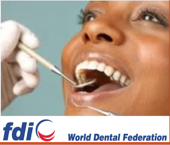 SAÚDE ORAL NOS PAÍSES EM DESENVOLVIMENTO. FDI –WORLD DENTAL FEDERATION APONTA OS DESAFIOS