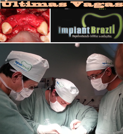 12º CURSO INTERNACIONAL INTENSIVO AVANÇADO EM IMPLANTES E ENXERTOS ÓSSEOS