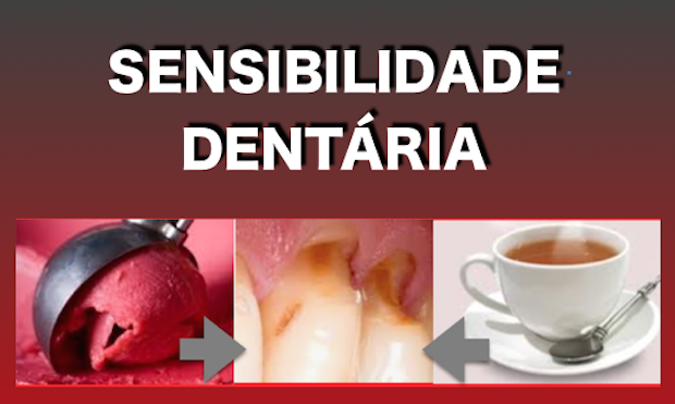 CIENTISTAS TESTAM NOVO BIOMATERIAL PARA REDUZIR A SENSIBILIDADE DENTÁRIA