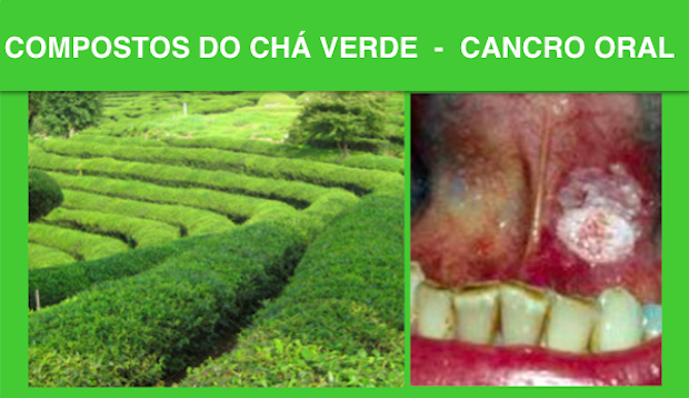 O CHÁ VERDE PODE COMBATER CANCRO ORAL