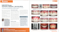 Publicação de artigos  Clínico no JornalDentistry