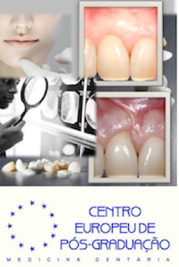 CURSO DE CIRURGIA PERIODONTAL