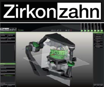 ZIRKONZAHN SCAN SOFTWARE - FUNÇÕES PARA MELHORAR O FLUXO DE TRABALHO DIGITAL