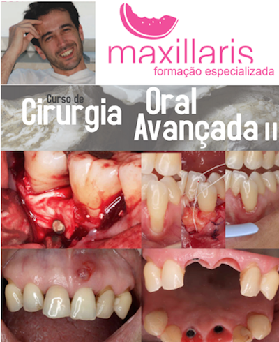 CURSO ORAL AVANÇADA II