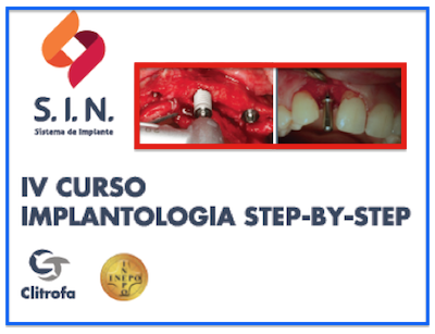 IV CURSO IMPLANTOLOGIA STEP-BY-STEP