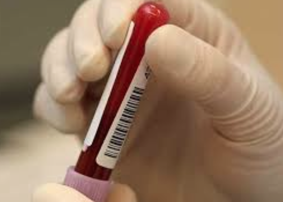 TESTE AO SANGUE PODE DETECTAR PRIMEIROS SINAIS DE CANCRO ORAL