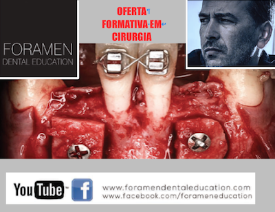 OFERTA FORMATIVA EM CIRURGIA DA FORAMEN DENTAL EDUCATION