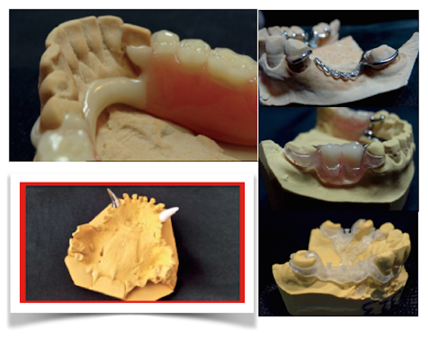 MORFODENTE – INOVAÇÃO NA PRÓTESE DENTÁRIA