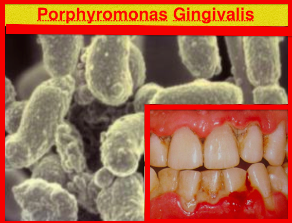 LUTA CONTRA PATÓGENOS PERIODONTAIS 