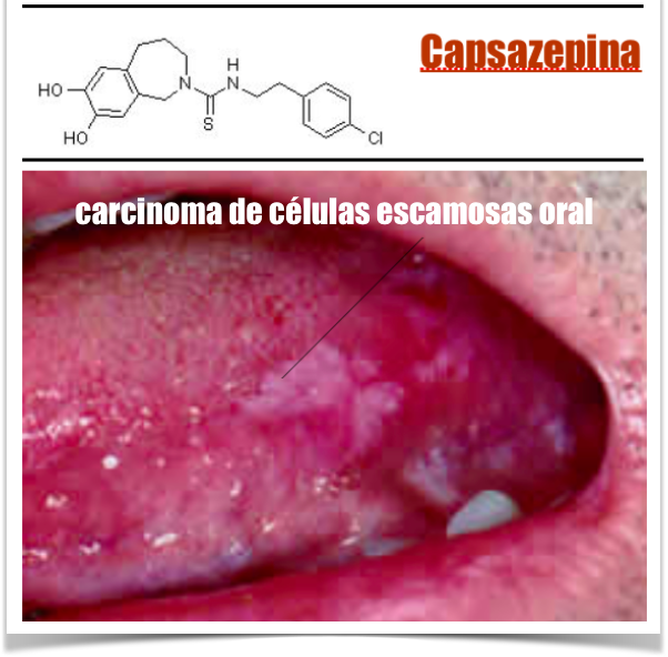 REDUÇÃO DO CANCRO ORAL COM  AGENTE ANTI-DOR (Capsazepina) POUPA OS TECIDOS SAUDÁVEIS  CIRCUNDANTES