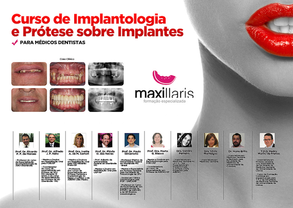 CURSO DE IMPLANTOLOGIA E PRÓTESE SOBRE IMPLANTES