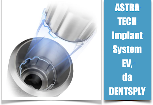 ASTRA TECH IMPLANT SYSTEM EV 