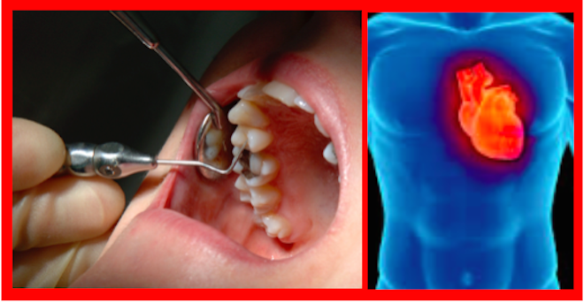 NOVAS PERSPETIVAS SOBRE A RELAÇÃO ENTRE SAÚDE ORAL E PREVENÇÃO DE DOENÇAS CARDÍACAS