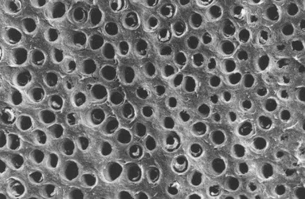 INVESTIGADORES ALEMÃES  DESCOBREM A ESTRUTURA INTERNA DA DENTINA