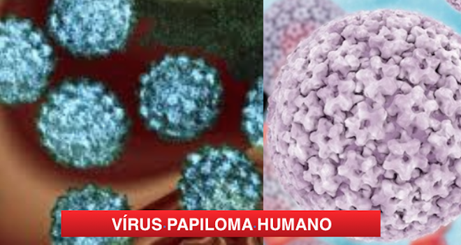 INFEÇÕES POR (HPV) ATRAVÉS DO BEIJO PODEM  SER  UM RISCO DE DESENVOLVIMENTO DE CANCRO OROFARÍNGICO