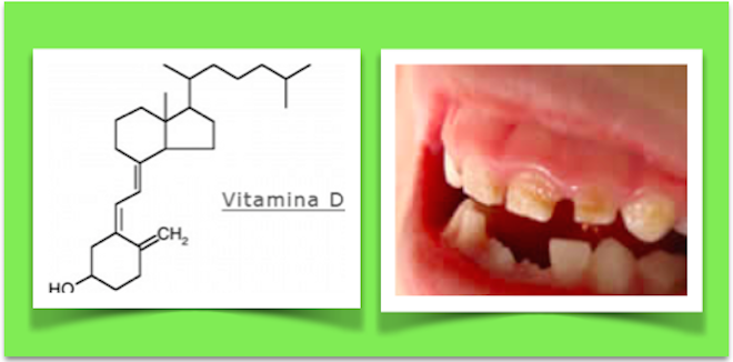 ESTUDO MOSTRA QUE OS NÍVEIS DE VITAMINA D DURANTE A GRAVIDEZ PODEM ESTAR RELACIONADOS COM SAÚDE DENTÁRIA DAS CRIANÇAS